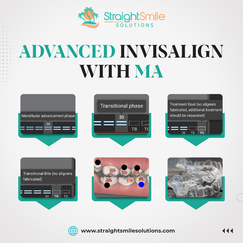 Align Technology's Invisalign Brand Selected as Official Smile