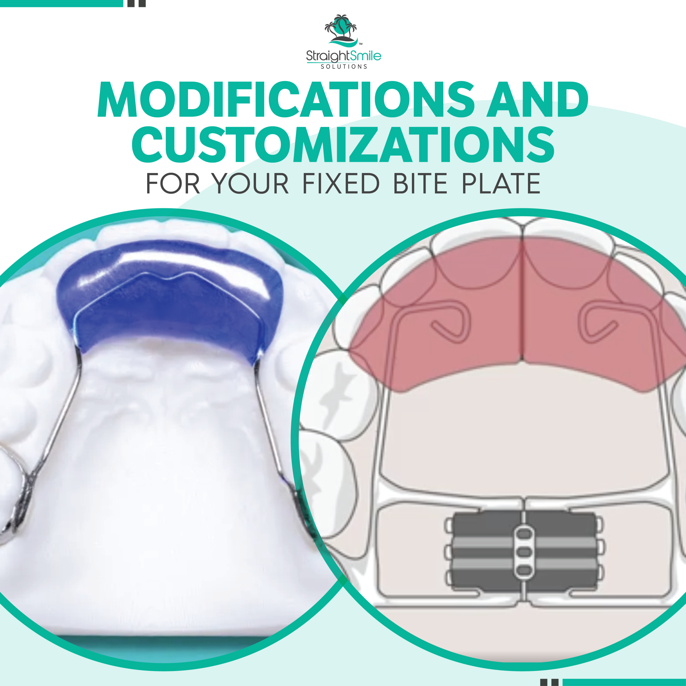 How to Modify Your Bite Plates