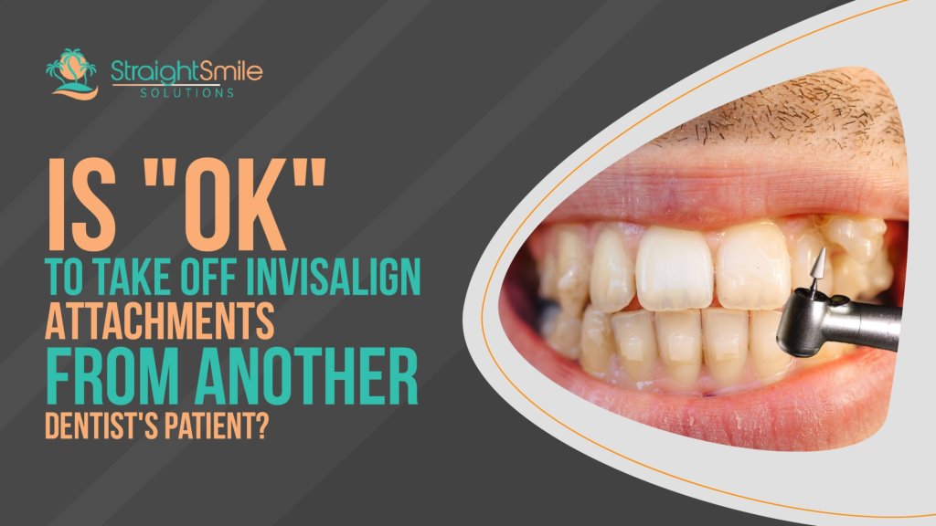 Jefferson Dental, Process of putting on Invisalign attachments!👏😁 Drop  all your Invisalign questions in comments!⤵️ #jeffersondental #invisalig